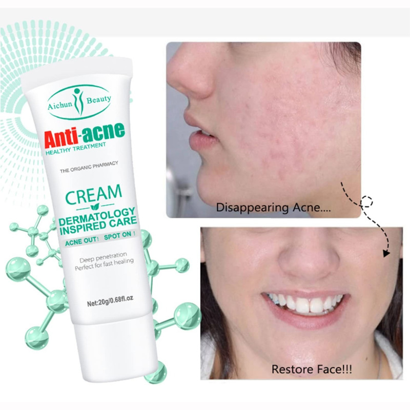 Aichun Beauty Anti-Acne Cream 20g – Tratamiento Corrector de Poros y Cicatrices.