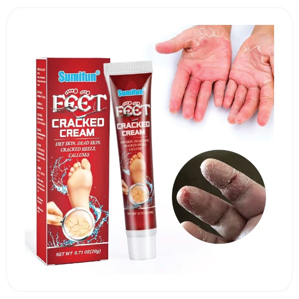 Sumifun 20g – Crema Reparadora para Manos y Pies Agrietados.