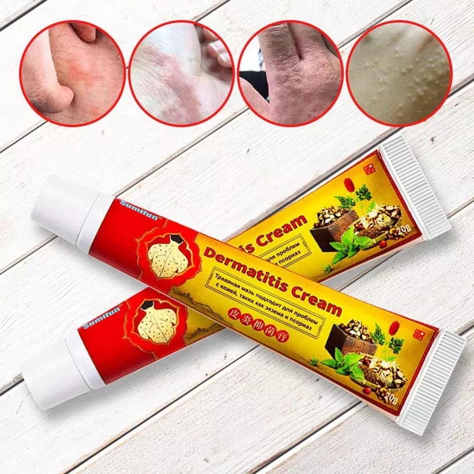 Sumifun Dermatitis Cream 20g – Pomada Herbal para Psoriasis, Eczema e Irritaciones.