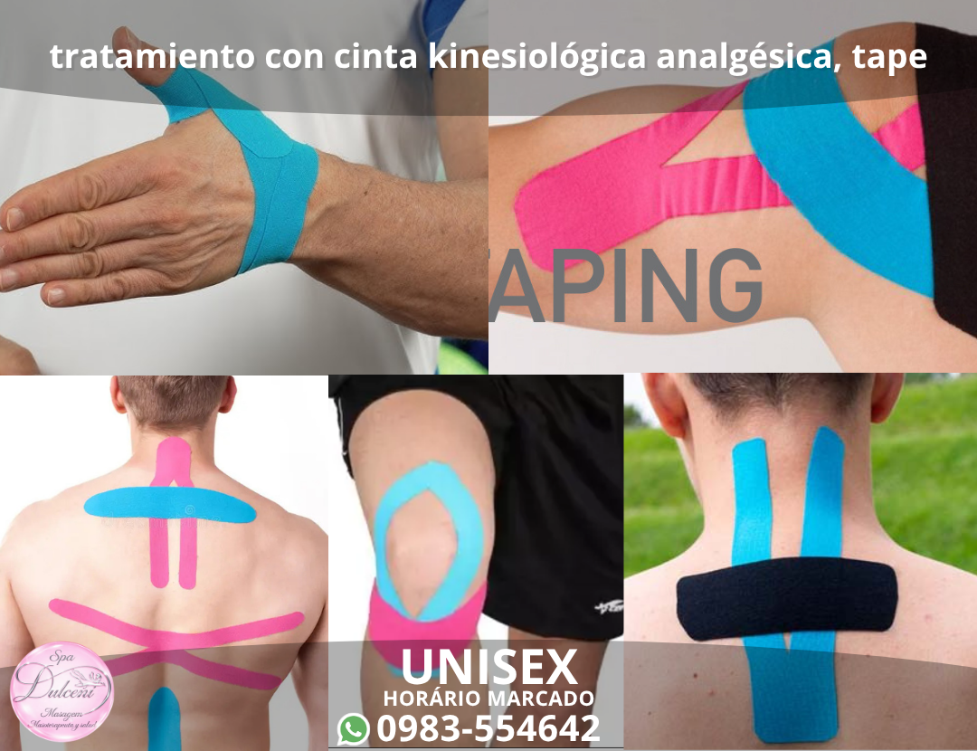 Tratamiento con cinta kinesiológica analgésica, tape